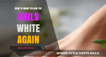 Restore Your Yellow Toenails: Simple Tips for a Brighter, Whiter Look