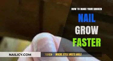 Quick Fixes: Accelerate Healing and Growth for Broken Nails