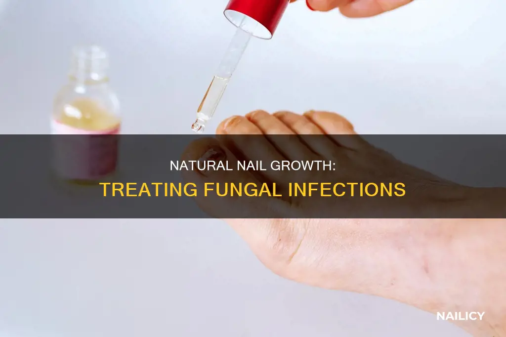 how to make your nails grow with fungus