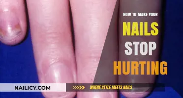 Soothe Sore Nails: Quick Remedies to Relieve Nail Pain Fast