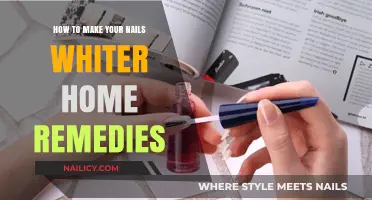 Natural Nail Whitening: Simple Home Remedies for Brighter, Healthier Nails