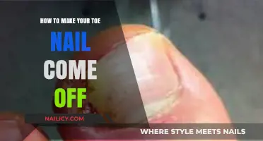 Effective Ways to Safely Remove a Loose Toenail at Home