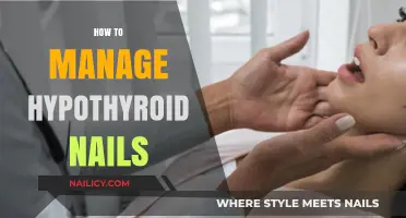 Nurturing Hypothyroid Nails: Effective Care and Management Tips
