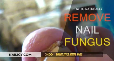 Eradicate Nail Fungus: Natural Remedies for Healthy Nails