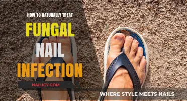 Effective Natural Remedies to Heal Fungal Nail Infections at Home