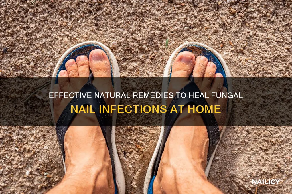 how to naturally treat fungal nail infection