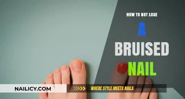 Save Your Bruised Nail: Quick Tips to Prevent Loss and Heal Fast