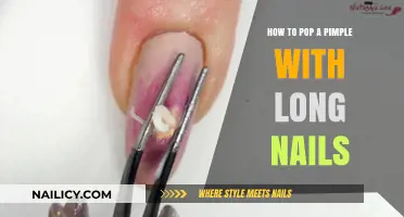 Popping Pimples with Long Nails: A Step-by-Step Guide