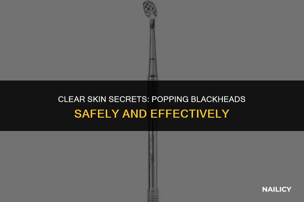 how to pop blackheads without using your nails
