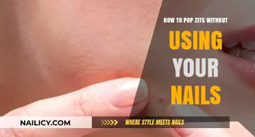 Clear Skin Secrets: Zit-Popping Techniques That Won't Damage Your Nails