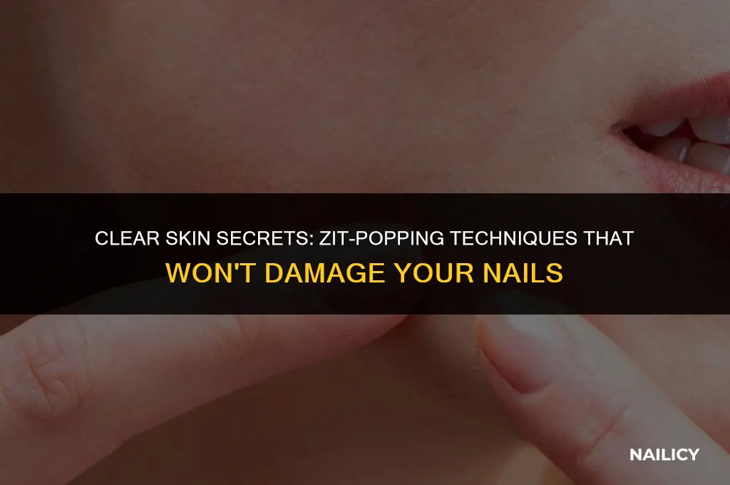 how to pop zits without using your nails