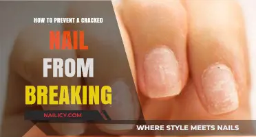 Prevent Nail Breaks: Quick Fixes for Cracked Nails