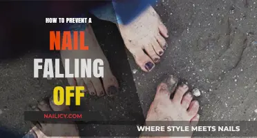 Preventing Nail Loss: Essential Tips to Keep Your Nails Intact