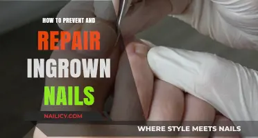 Prevent and Repair Ingrown Nails: Effective Tips for Healthy Toenails