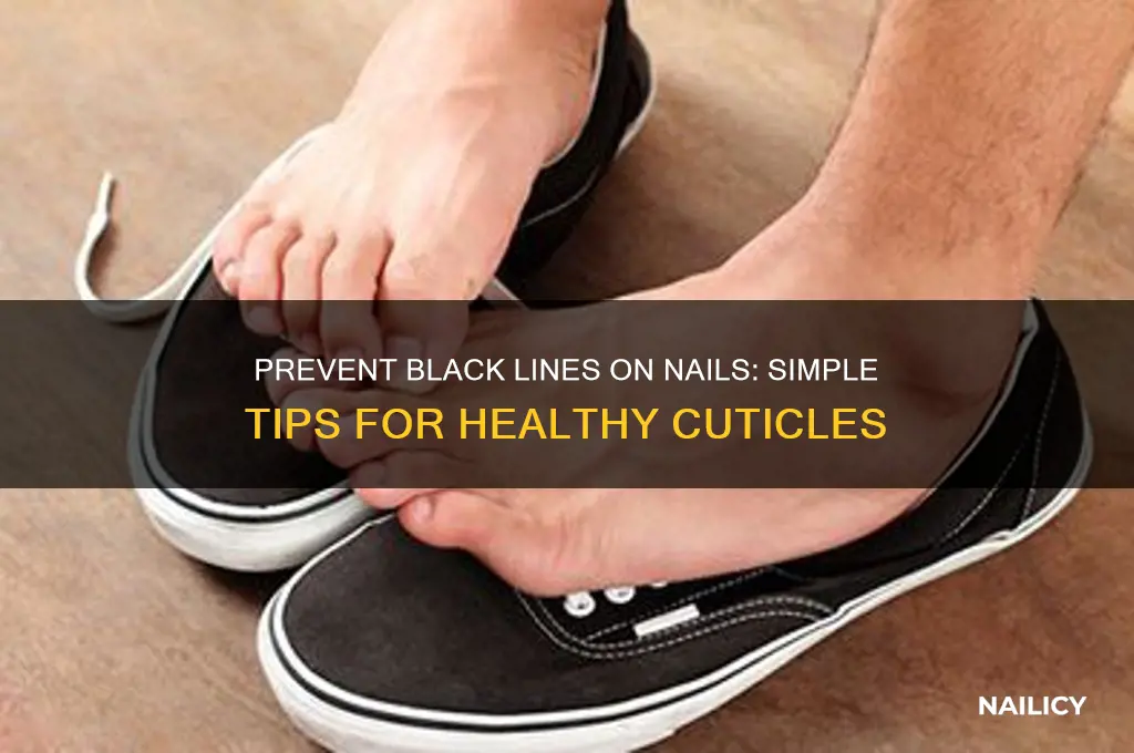 how to prevent black lines on nails