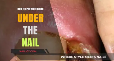 Prevent Blood Under Nail: Quick Tips for Healthy Fingertips