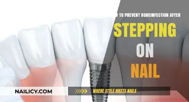 Preventing Bone Infections: Essential Steps After Stepping on a Nail