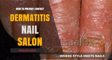 Prevent Contact Dermatitis at Nail Salons: Essential Tips for Healthy Skin