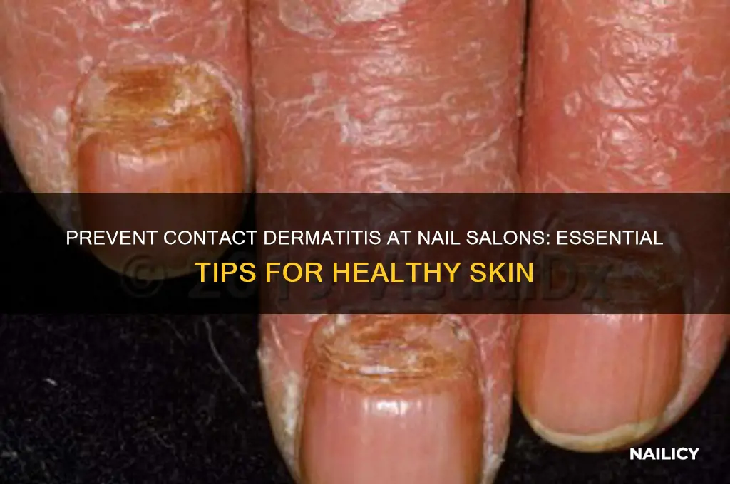 how to prevent contact dermatitis nail salon