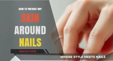 Prevent Dry Skin Around Nails: Simple Tips for Healthy Cuticles