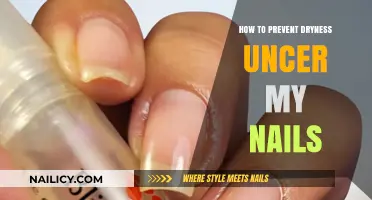 Prevent Nail Dryness: Simple Tips for Hydrated, Healthy Cuticles