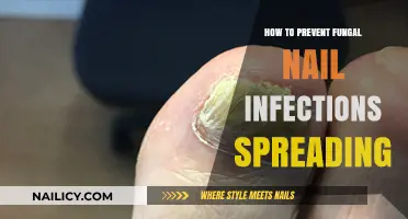 Stop Fungal Nail Infections from Spreading: Effective Prevention Tips