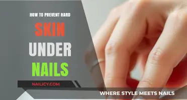 Prevent Hard Skin Under Nails: Simple Tips for Healthy Cuticles