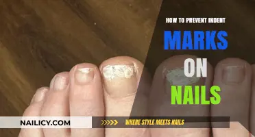 Prevent Nail Indent Marks: Simple Tips for Smooth, Healthy Nails