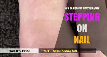 Preventing Infection: Essential Steps After Stepping on a Nail