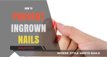 Effective Tips to Prevent Painful Ingrown Nails Naturally and Easily