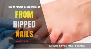 Prevent Ingrown Toenails: Tips for Healing Ripped Nails Safely