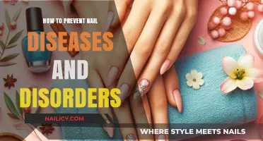 Essential Tips for Healthy Nails: Preventing Diseases and Disorders