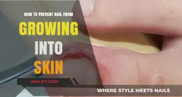 Preventing Nails Growing into Skin: A Simple Guide