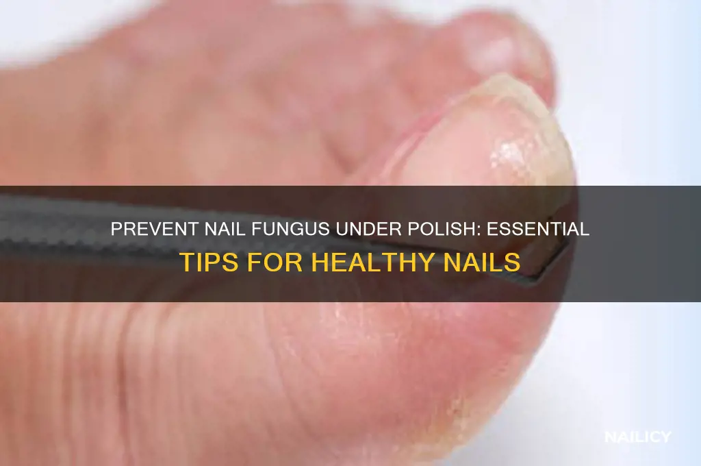 how to prevent nail fungus under polish