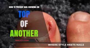 Preventing Ingrown Nails: Tips and Tricks