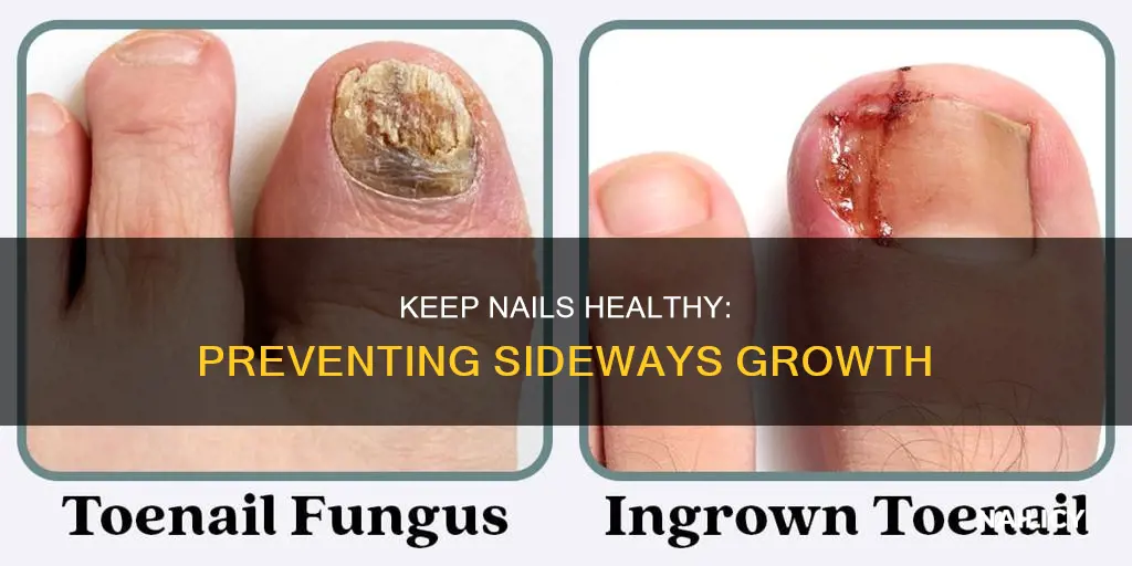 how to prevent nails from growing sideways