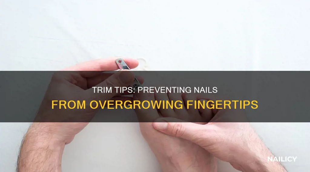 how to prevent nails growing past the fingertips