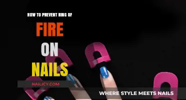 Preventing Nail Ring of Fire: Effective Tips for Healthy Nails