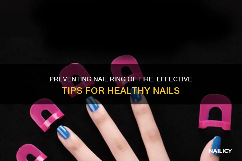 how to prevent ring of fire on nails