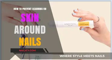 Prevent Nail-Area Scarring: Gentle Care Tips for Healthy Skin
