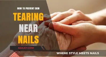 Preventing Painful Skin Tears Around Nails: Gentle Care Tips