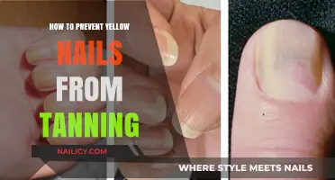 Prevent Yellow Nails from Tanning: Tips for Healthy, Glowing Nails
