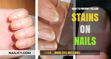 Prevent Yellow Nails: Tips for Stain-Free, Healthy Manicures