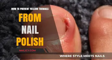 Prevent Yellow Toenails: Tips for Healthy, Polish-Protected Nails