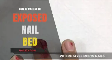 Heal and Shield: Effective Ways to Protect an Exposed Nail Bed