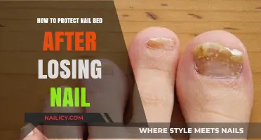 Healing and Protecting Your Nail Bed: Post-Injury Care Guide