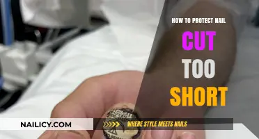Protecting Nails Cut Too Short: Quick Fixes