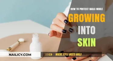 Protecting Nails: Tips to Avoid Painful Ingrown Nails
