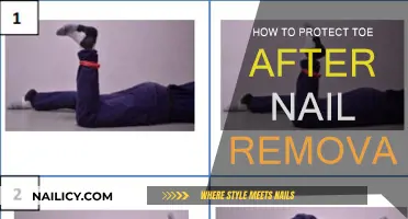 Protect Your Toes: Post-Nail Removal Care