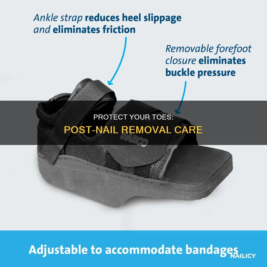 how to protect toe after nail removal